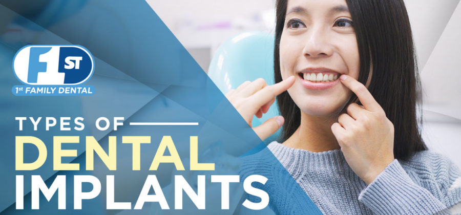Type of Dental Implants - 1st Family Dental, IL