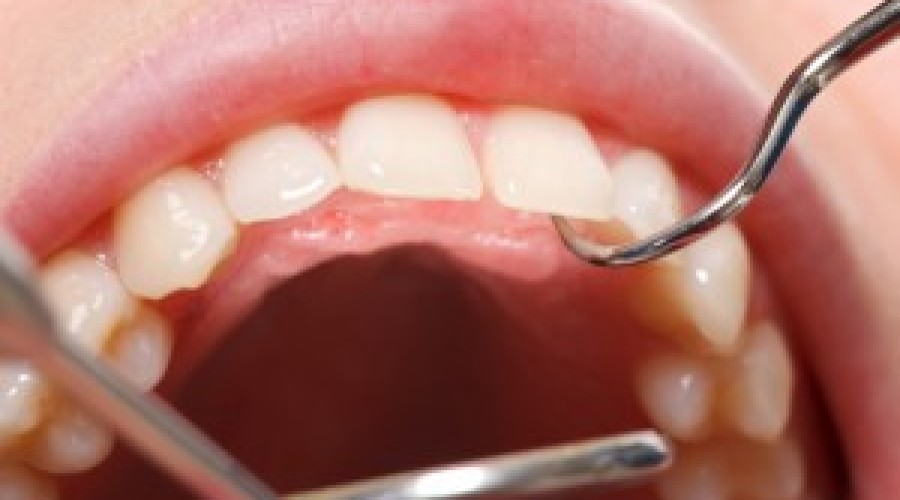 Dental Tooth Exam