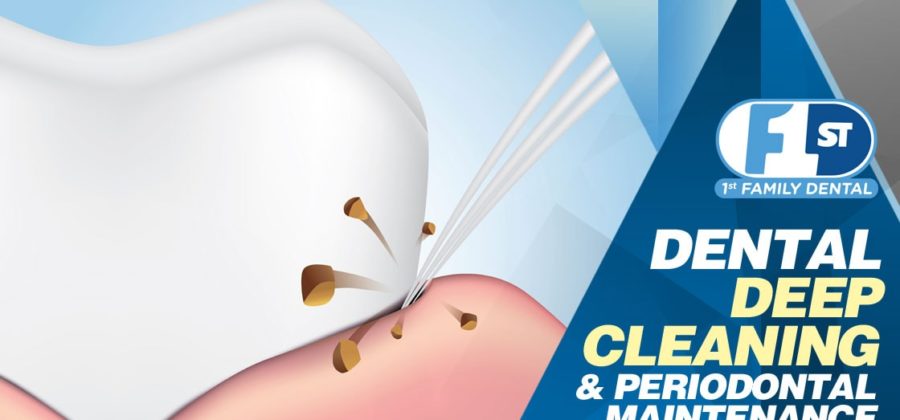 Dental Deep Cleaning & Periodontal Maintenance