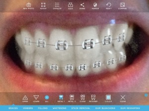 Virtual Dentist by Modiface