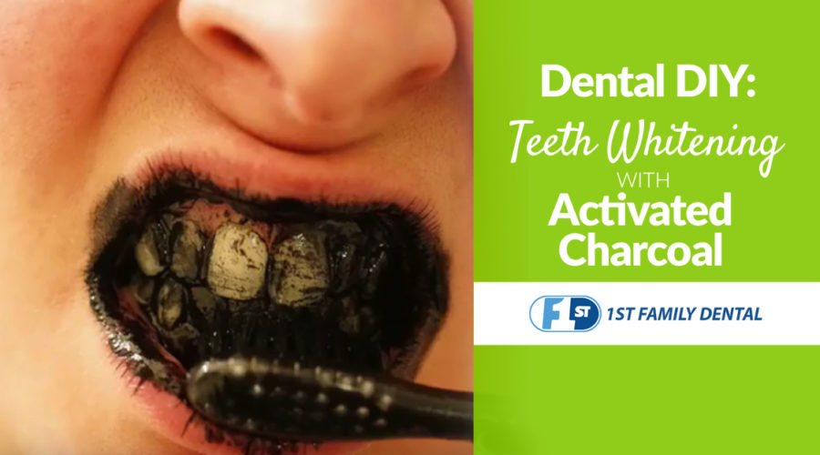 teeth whitening with activated charcoal - 1st Family Dental Blog