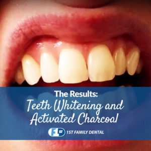 the results teeth whitening and activated charcoal - dental DIY blog