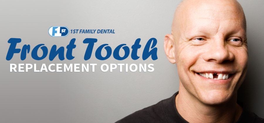 front tooth replacement options