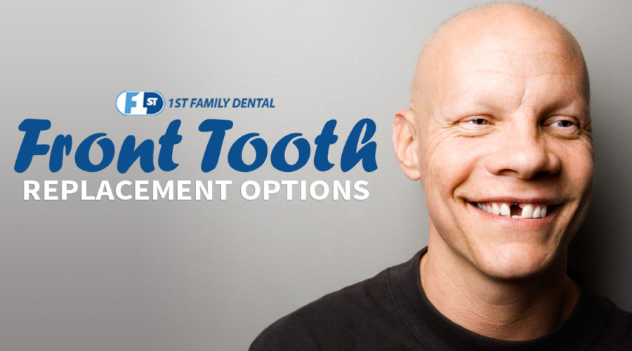 front tooth replacement options