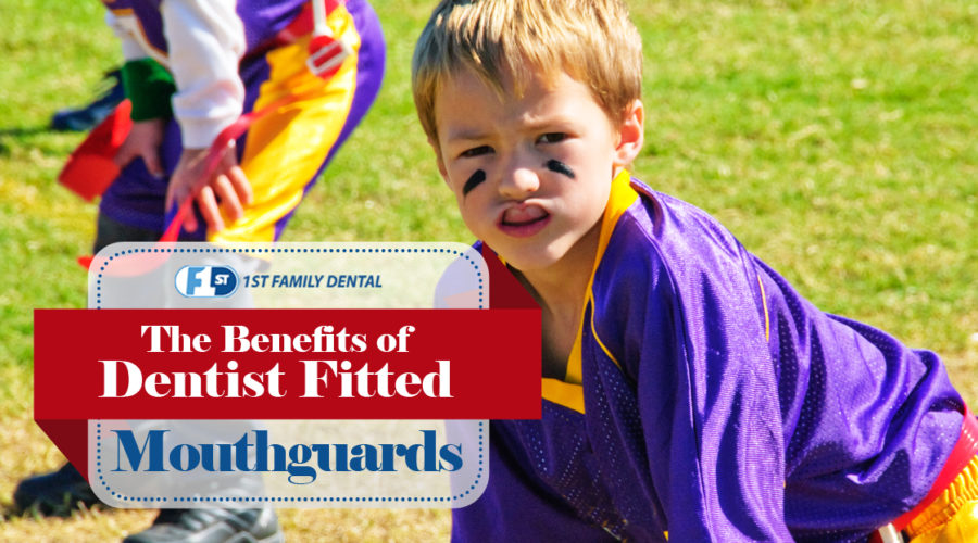 the benefits of dentist fitted mouthguards