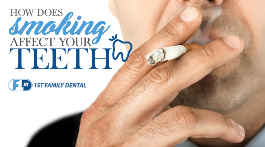 how does smoking affect your teeth - 1st family dental