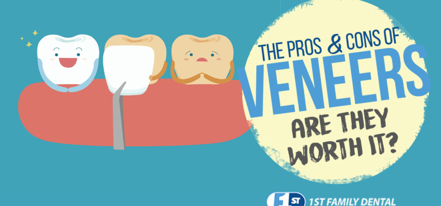 the pros and cons of veneers - 1st Family Dental
