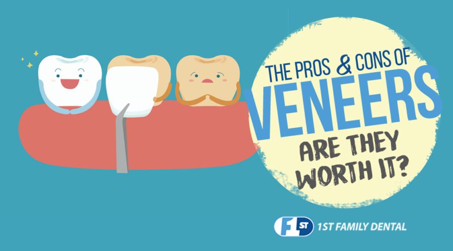 the pros and cons of veneers - 1st Family Dental