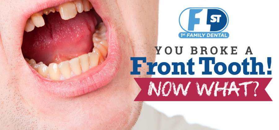 Broken Front Tooth - Now What? Chicago, IL Emergency Dentist