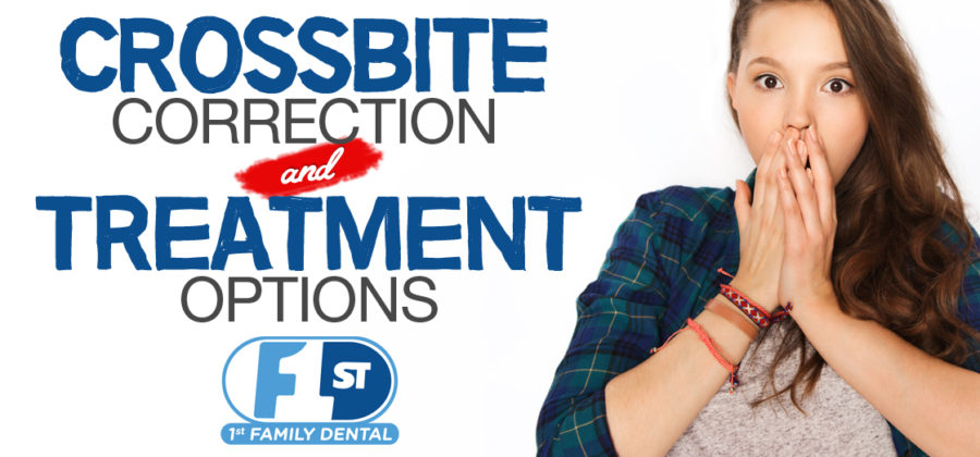 crossbite correction and treatment options - for teens and adults - Chicago, IL