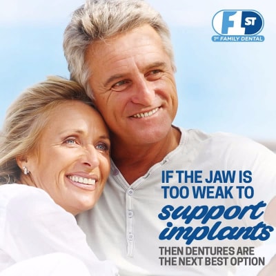 Chicago Dentures vs Implants pros and cons