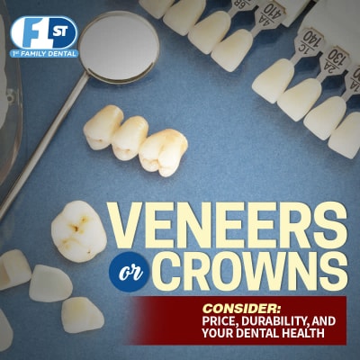 1FD Crowns or Veneers version one 400x400-min