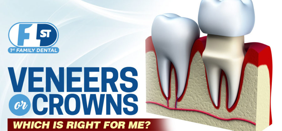 veneers or crown - 1st Family Dental Chicago IL