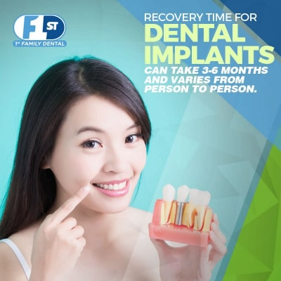 Dental Implants Recovery Time