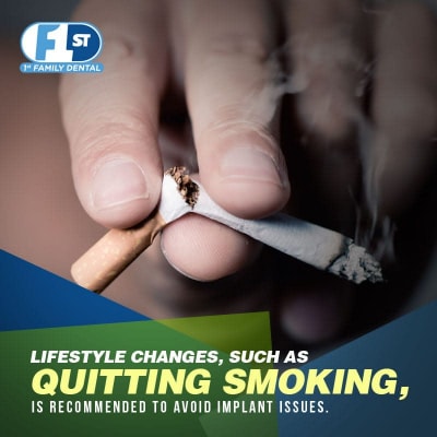 Quitting Smoking to avoid Implant Issues