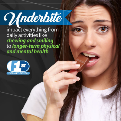 Underbite - 1st Family Dental