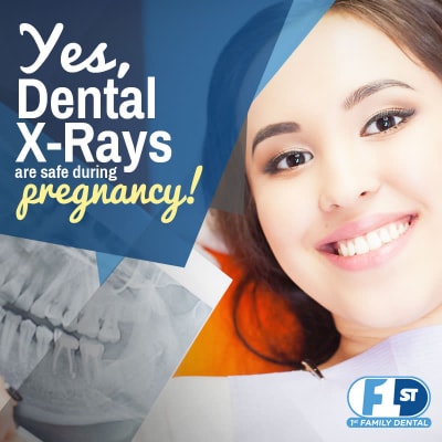 Are Dental X-rays safe during pregnancy - 1st Family Dental Blog