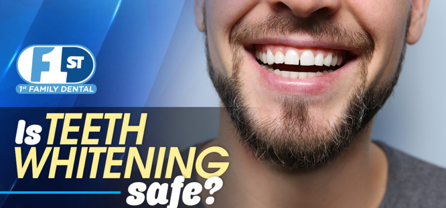 is teeth whitening safe?
