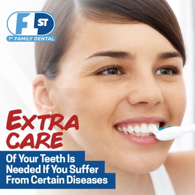 Extra Care of Your Teeth