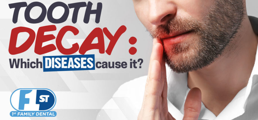 diseases that cause tooth decay - 1st Family Dental