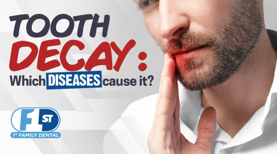 diseases that cause tooth decay - 1st Family Dental