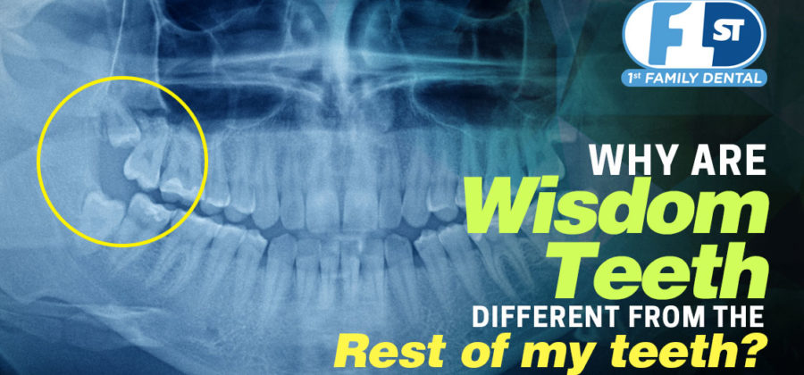 Signs You Need Your Wisdom Teeth Taken Out - 1st Family Dental Chicago