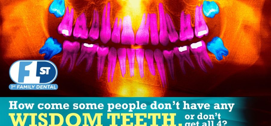 Wisdom Teeth - 1st Family Dental