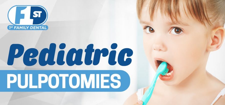 Pediatric-Pulpotomies