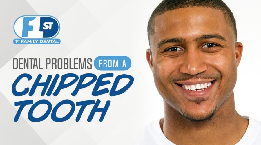 Dental Problems From a Chipped Tooth - min