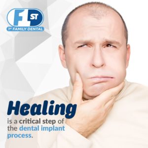 healing is important step in dental implant process