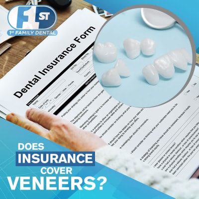 1st Family Dental - Does insurance cover veneers