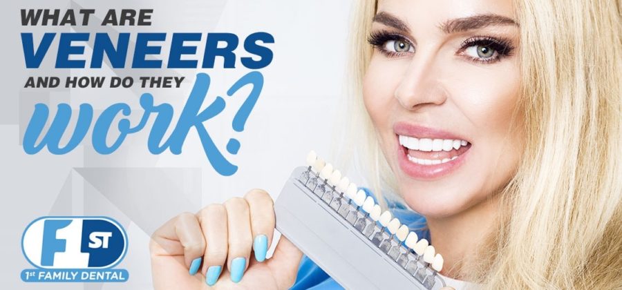 What are Veneers - 1st Family Dental, Chicago IL
