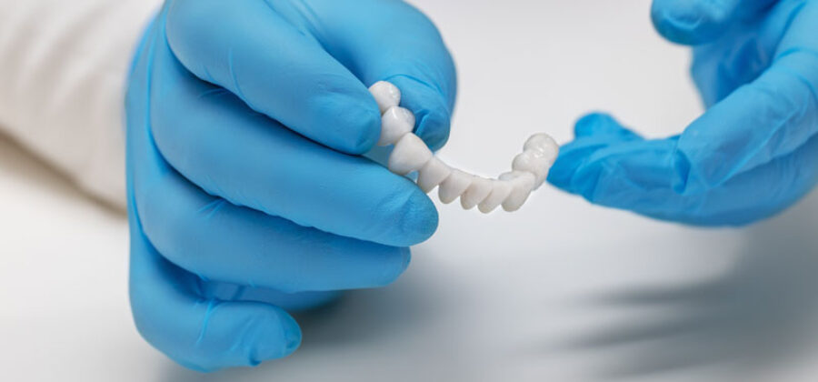 a full mouth dental implant model