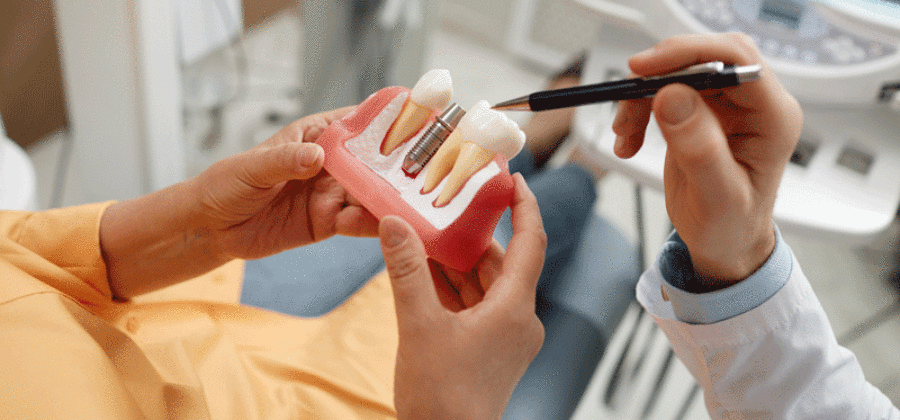 Woman holding tooth model during consultation on dental implant