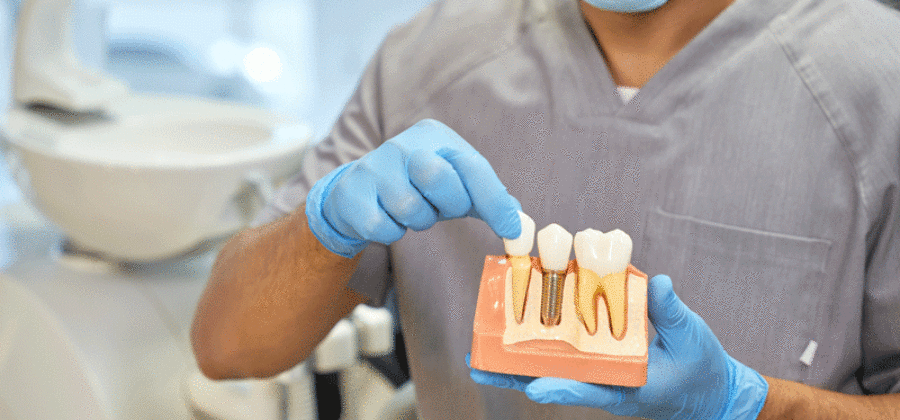 A dental doctor with a model of a dental implant in his hands