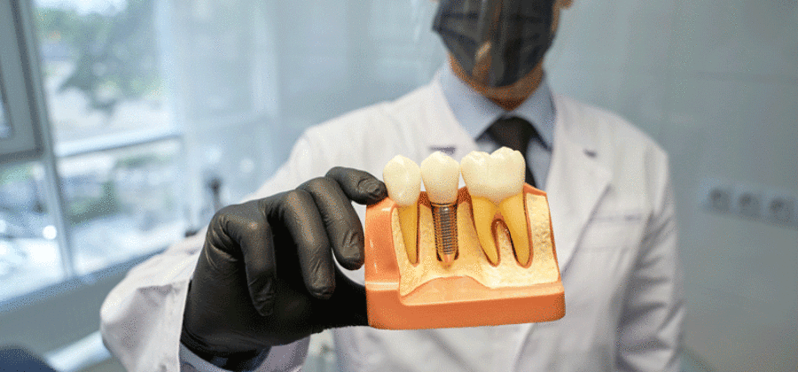 Doctor holding a model of a dental implant
